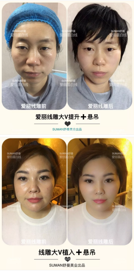 鄭州美博會展商案例